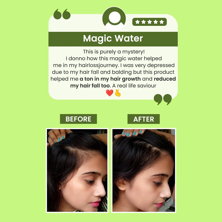 Rosemary Water, Hair Spray For Regrowth Buy 1 Get 2 Free